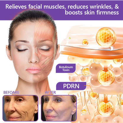 HISKIN® PDRN Multi-Peptide Massaging Body Roller Cream- Anti-aging, Hydrating, Skin Firming & Lifting, Skin Repair, Even Tone, Acne and Dark Spot Treatment, Wart and Mole Removal, and Psoriasis Relief.