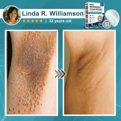 ✨Hiskin ® 2-in-1 Microneedle & Hydrocolloid Patch🍀 | Removes raised moles, acne, flat warts, and skin tags | Helps improve wrinkles, scars, and blemishes | Invisible patches for face and body