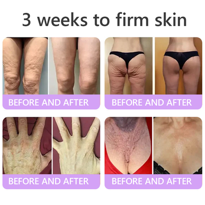 HISKIN® PDRN Multi-Peptide Massaging Body Roller Cream- Anti-aging, Hydrating, Skin Firming & Lifting, Skin Repair, Even Tone, Acne and Dark Spot Treatment, Wart and Mole Removal, and Psoriasis Relief.