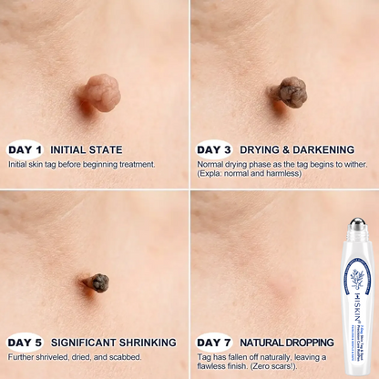 ✨Hiskin® Restore flawless bump-free skin effortlessly. Miss out now, and you won't have another chance until next year.