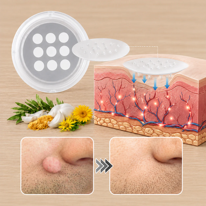 ✨Hiskin ® 2-in-1 Microneedle & Hydrocolloid Patch🍀 | Removes raised moles, acne, flat warts, and skin tags | Helps improve wrinkles, scars, and blemishes | Invisible patches for face and body