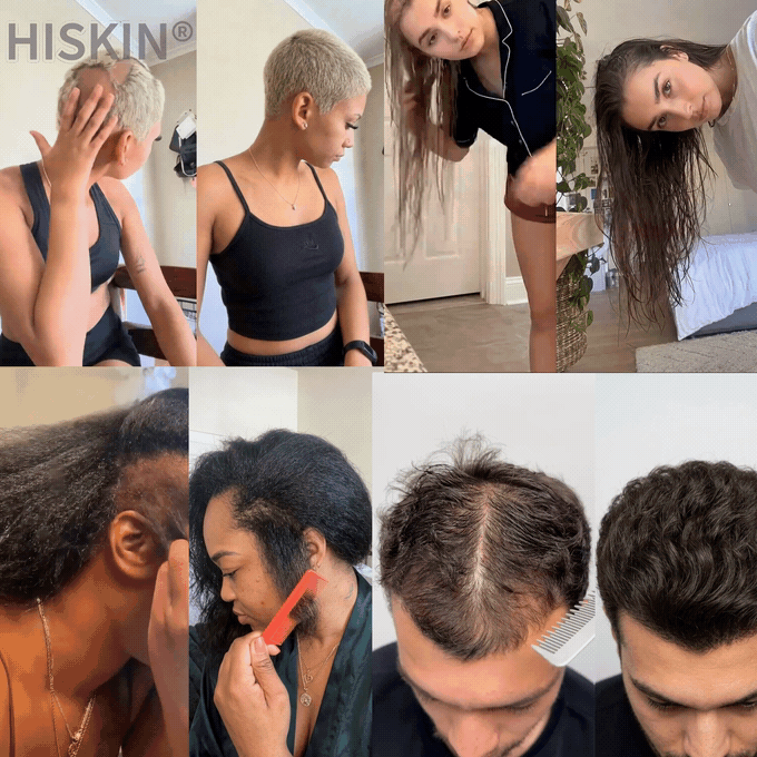𝐇𝐈𝐒𝐊𝐈𝐍® Only 5 boxes left! We're offering you an additional 30% discount!